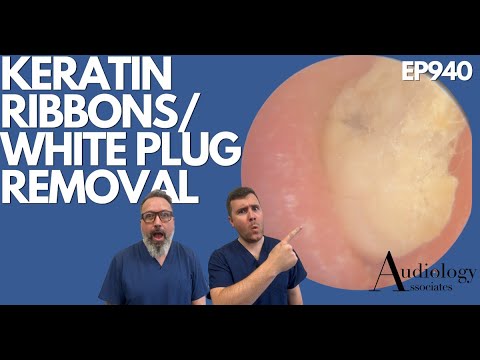 Видео: КЕРАТИНОВЫЕ ЛЕНТЫ/УДАЛЕНИЕ УШНОЙ СЕРЫ И БЕЛЫХ ПРОБОК ИЗ УШЕЙ - EP940