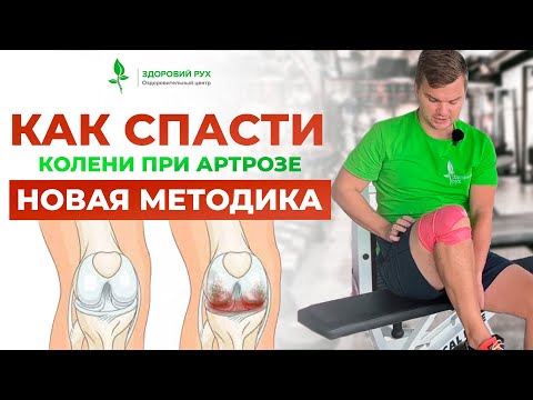 Видео: 3 упражнения для КОЛЕН. НОВЫЙ МЕТОД при АРТРОЗЕ| Кинезитерапия