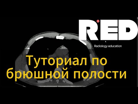 Видео: Туториал для молодых специалистов, куда смотреть при описании брюшной полости.