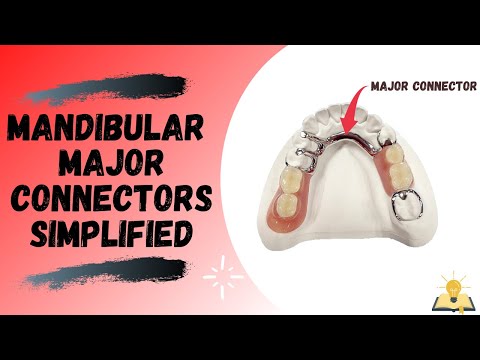 Видео: Коннекторы для больших нижних челюстей | Съемный частичный протез (ЧП)