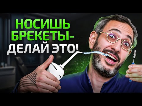 Видео: 4 совета от стоматолога, как ухаживать за брекетами