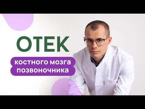 Видео: Отек костного мозга позвоночника и боль в спине. Врач-вертебролог г. Санкт-Петербург