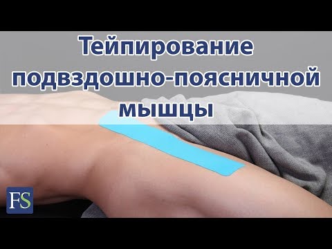 Видео: Тейпирование подвздошно-поясничной мышцы при болях в тазобедренном суставе