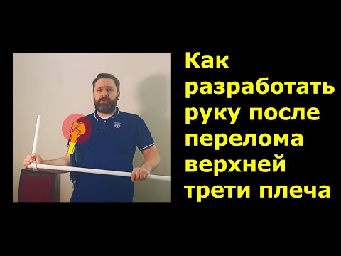 Видео: Как разработать руку после перелома верхней трети плеча.