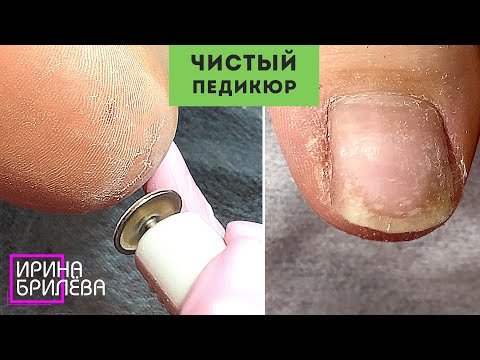 Видео: Чистый ПЕДИКЮР 🌸 Обработка ТРЕЩИН дисками 🌸 Ирина Брилёва