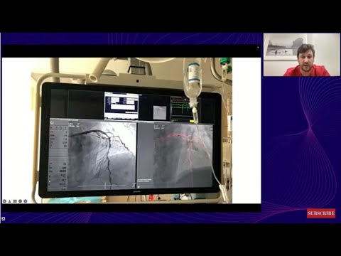 Видео: Новый взгляд на проведение ЧКВ - динамическое картирование коронарных сосудов и визуализация стентов