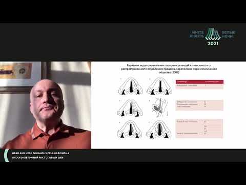 Видео: Ранний рак гортани. Эндоскопические возможности в лечении пациентов (Мудунов А. М.)