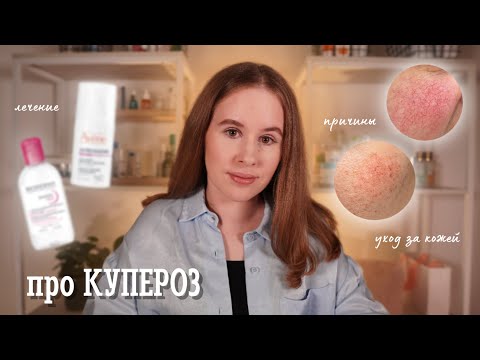 Видео: КУПЕРОЗ: причины, уход, методы коррекции