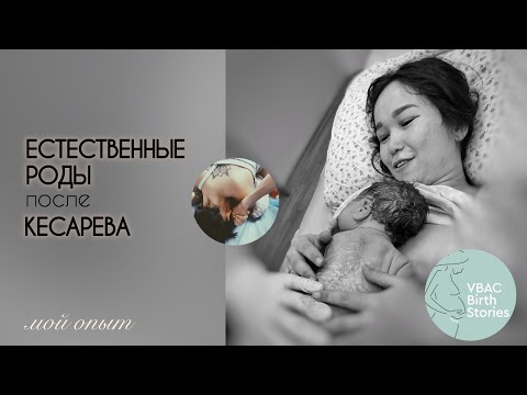 Видео: ЕСТЕСТВЕННЫЕ РОДЫ после КЕСАРЕВА |История ЕРпКС. Подготовка к родам #ЕРПКС