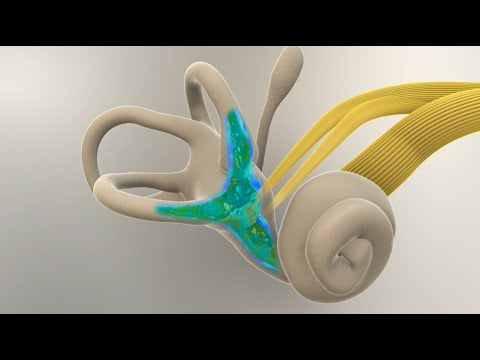 Видео: Болезнь Меньера - Что происходит во внутреннем ухе?
