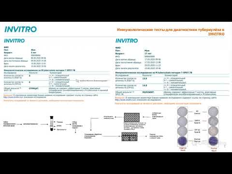 Видео: T-SPOT, Квантифероновый тест. Современная лабораторная диагностика туберкулёза.
