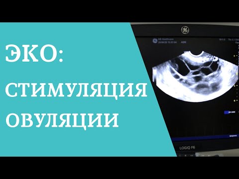 Видео: Как проходит ЭКО - I этап: стимуляция овуляции