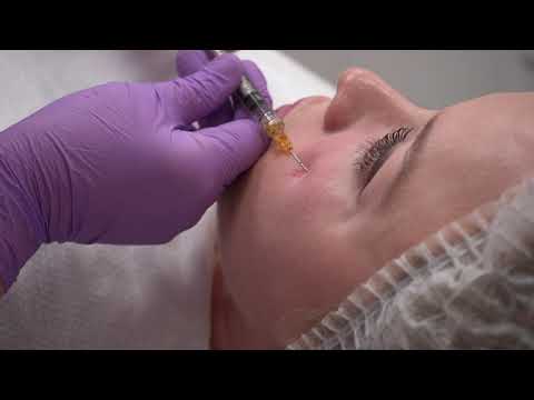 Видео: Сферогель Long fine