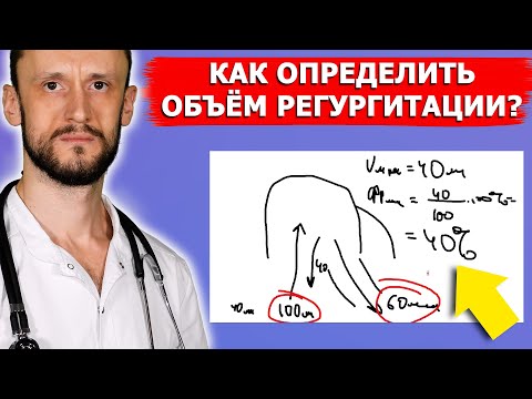 Видео: Как определить объем (фракцию) регургитации?