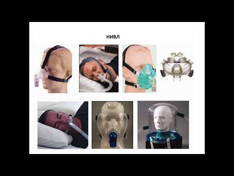 Видео: Искусственная вентиляция лёгких (4 часть)