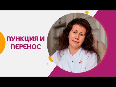 Видео: 🔬Как происходит пункция фолликулов при ЭКО и перенос эмбриона? Как происходит пункция фолликулов.12+