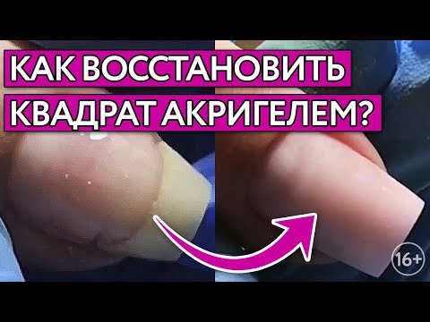 Видео: Как сделать квадрат акригелем? / Восстановление акригелем на повреждённом ногте
