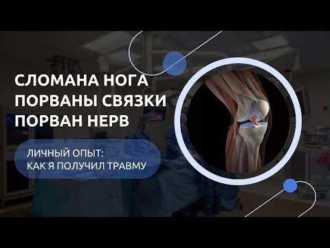 Видео: Как я сломал ногу, разорвал связки и повредил малоберцовый нерв( отвисшая стопа)вся боль без прикрас