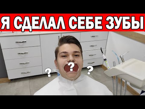 Видео: СДЕЛАЛ СЕБЕ ЗУБЫ В ТУРЦИИ/ СКОЛЬКО СТОИТ ЛЕЧЕНИЕ ЗУБОВ?/ КОРОНКИ/ИМПЛАНТЫ/ ИНТЕРВЬЮ У ВРАЧА/ Анталия