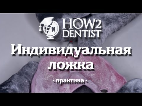 Видео: Как сделать индивидуальную ложку / How to Dentis