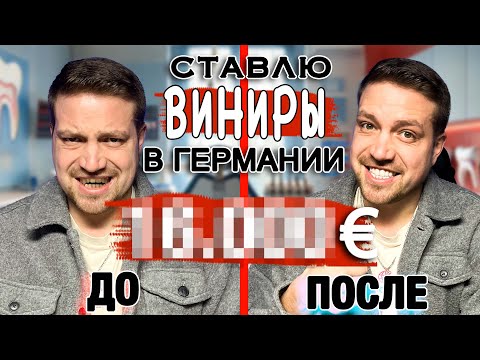 Видео: Сколько я заплатил за ВИНИРЫ в Германии и почему я их поставил !