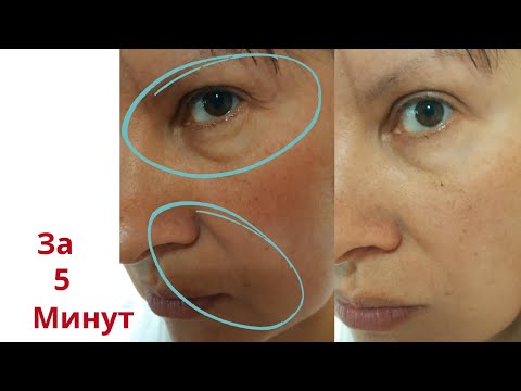 Видео: Омоложение за 5 минут! Без косметики! От отеков и морщин.