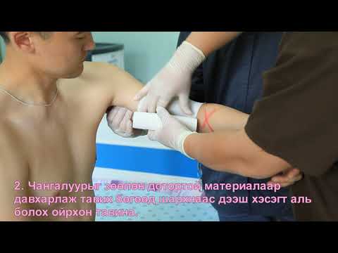 Видео: Цус тогтоох Чангалуур тавих