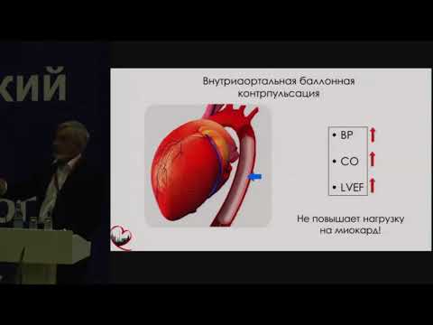Видео: Шпектор А.В. Шок при остром инфаркте миокарда: дифференциальный диагноз и лечение | Инфаркт миокарда