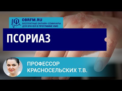 Видео: Профессор Красносельских Т.В.:  Псориаз