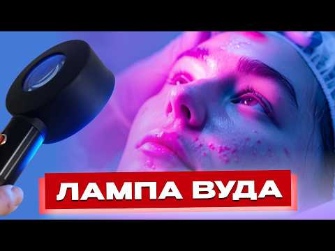 Видео: Что скрывает ваша кожа? Лампа Вуда: что важно знать