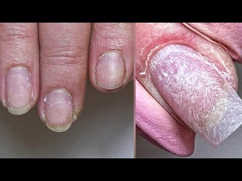 Видео: Проблемная Кутикула/ Сложный Маникюр