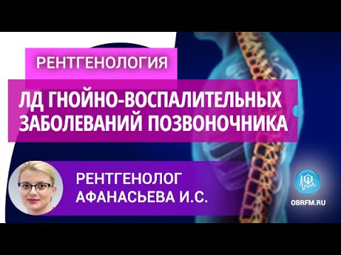 Видео: Рентгенолог Афанасьева И.С.: Луч-я ди-ка неспецифических гнойно-воспалительных заб-ний позвоночника