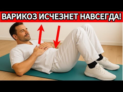 Видео: ШОК😱ВАРИКОЗ РЕАЛЬНО ЛЕЧИТСЯ! ПРОСТЫЕ СРЕДСТВА ЕСТЬ В ДОМЕ КАЖДОГО!