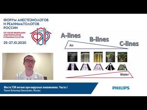 Видео: УЗИ легких при вирусных пневмониях I часть Лыхин ВН