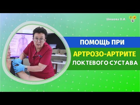 Видео: ПОМОЩЬ ПРИ АРТРОЗО-АРТРИТЕ ЛОКТЕВОГО СУСТАВА. [Шишова О И.]