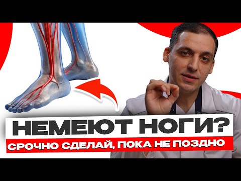 Видео: Немеют ноги - что делать? СТРАШНЫЕ последствия. 3 способа лечения