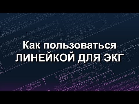 Видео: Как пользоваться линейкой для ЭКГ