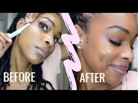 Видео: Мой любимый секрет красоты: дермапланинг или масляное пилингование — какой метод лучше всего подх...