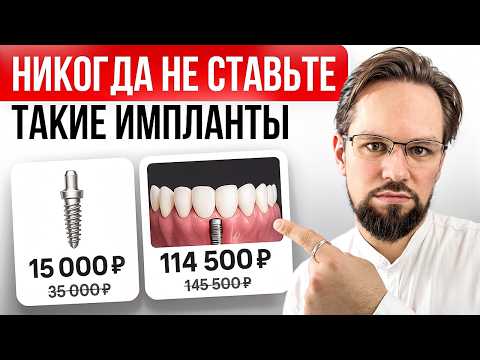 Видео: Стоматологи не говорят это об имплантах! Какой имплант выбрать в 2025?