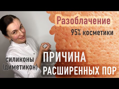 Видео: РАЗОБЛАЧЕНИЕ 95% КОСМЕТИКИ! РАСШИРЕННЫЕ ПОРЫ! ЧТО ТАКОЕ СИЛИКОНЫ И ДИМЕТИКОН? - ОТВЕТ КОСМЕТОЛОГА