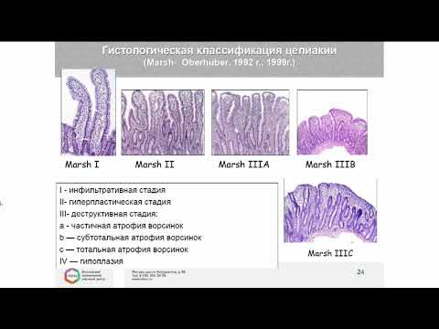Видео: Симпозиум: «Многоликая целиакия»