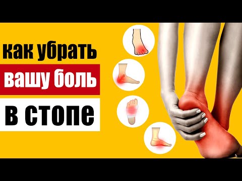 Видео: Почему болит стопа – определяем причину самостоятельно и снимаем боль проверенными методами
