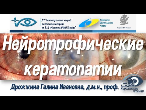 Видео: Нейротрофические кератопатии