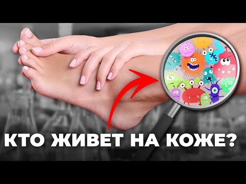 Видео: ВРЕДНЫЕ или ПОЛЕЗНЫЕ МИКРОБЫ / Что скрывает кожа и микробиом?