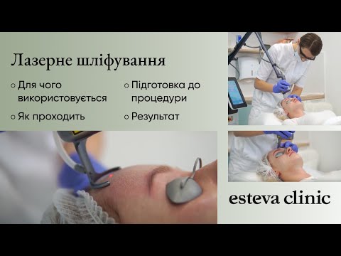 Видео: Лазерне шліфування обличчя в Esteva Сlinic