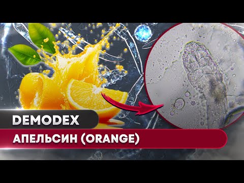 Видео: Апельсиновая корка vs. Клещи Demodex – Убьёт или нет? 🔬🍊
