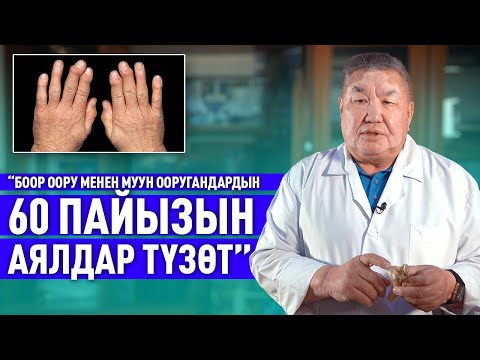 Видео: Муун оорууларынын келип чыгуу себептери