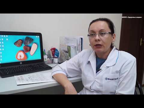Видео: Папилломавирусная инфекция