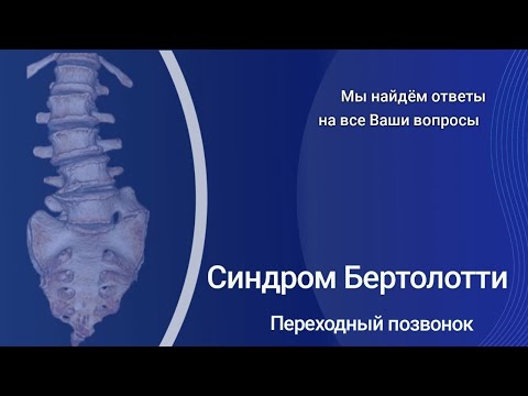 Видео: Синдром Бертолотти