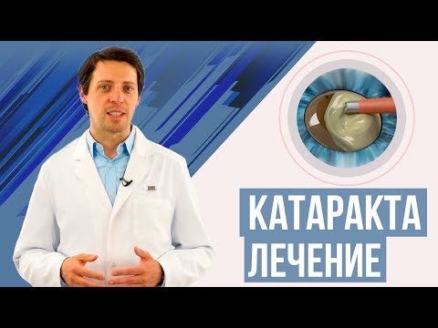 Видео: Катаракта лечение.